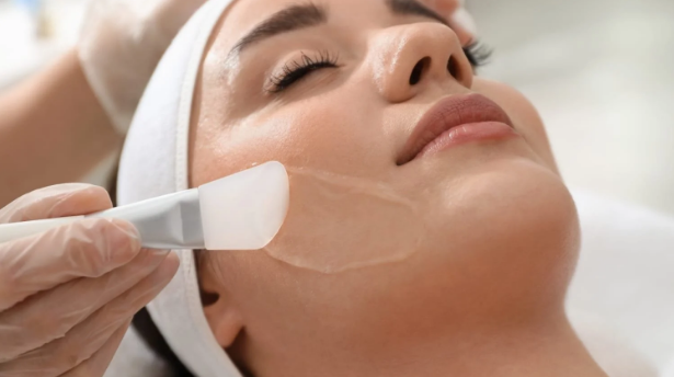 Chemical peels