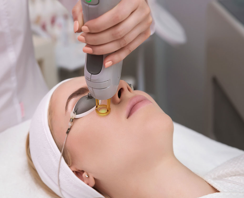 Skin Resurfacing